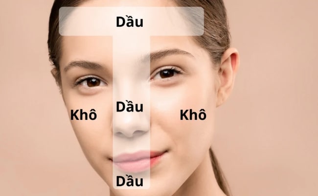 Da hỗn hợp là gì?